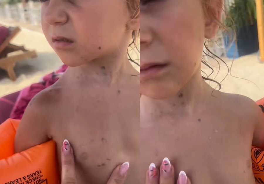 Agron Shehaj tr*ndit: E rende në Durrës: Vajza 4-vjeçare del nga deti “e mbuluar” nga nafta, cfare i ndodhi (Video)